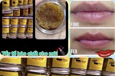 Dị ứng, sưng môi vì dùng kem tẩy da chết “handmade”